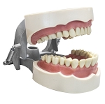 1560 Upper and Lower Soft Gingival Jaws with 32 Removable Indexed Teeth and MQD